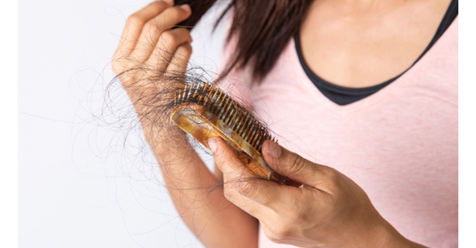 Hair Loss: What is Alopecia?